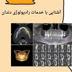 بررسی جزئیات روش های رادیولوژی دندان
