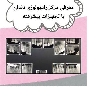 اشنایی با خدمات رادیولوژی دندان سعادت آباد